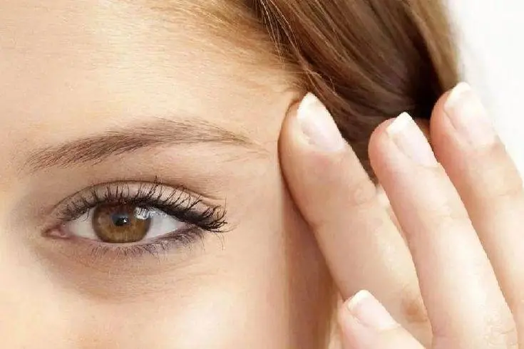 بوتاکس چشم گربه ای ۱۴۰۵